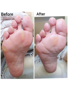 リゼラアンドコー 神戸店/