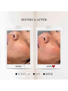 エクラ アン(eclat.un)/４０代女性：ララピール