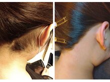 トリニティスペース(TrinitySpace)/うなじワックス脱毛