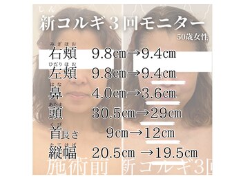 エイミー(Amy)/新コルギはメジャーリングから