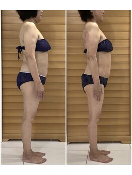 エゴ(EGO)/40代半ば 154.0cm 10.3キロ減