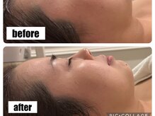 アモ 夢シティ新下関(AMO.)/セラピール