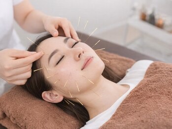 メリオレム 三軒茶屋(meliorem)の写真/話題の“レッドショット”導入！『小顔・リフトアップ』に特化★地域トップレベルの美容鍼を体験できる◎