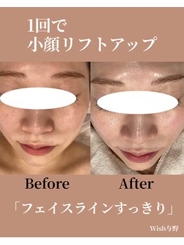 ウィッシュ 与野(Wish)/透明感、ここまで変わる。