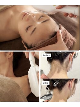 ワイズサロン(Y's salon)の写真/うなじだけ・VIOだけ・ワキだけ・顔だけなど気になる部位を選んで施術◎必要な部位を無駄なくキレイに♪