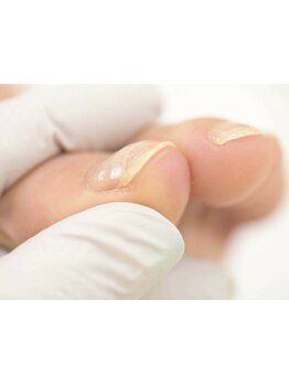 爪の悩みを解消できる（ケア含む）