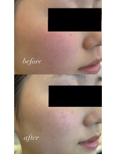 ザ フェース 京都御池店(THE FAITH)/一瞬で変わる美容液♪