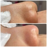 シャルム(Charme)