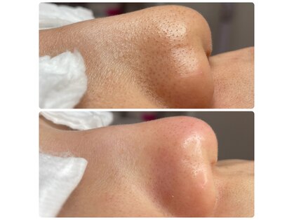 シャルム(Charme)の写真