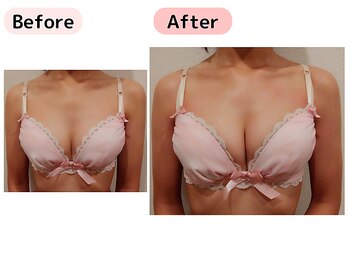 ピーグランディ 栄店(p-Grandi)/【お悩み】バストのハリとサイズ