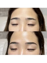 アイリー(IRIE)/HBL＋フェイスワックス