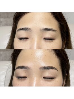 アイリー(IRIE)/HBL＋フェイスワックス