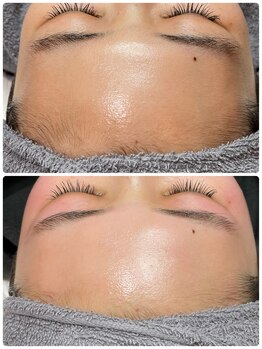 エードット(A.)/スキンケアフェイシャルワックス