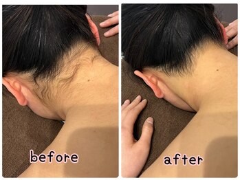 ケースタイル(k.style)/うなじbefore after