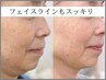 【もたつき二重顎を解消】表情筋テラボーラー＋小顔テラパックで横顔美人