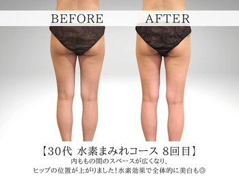 ヨサパーク ククナ 大塚(YOSA PARK kukuna)/痩身/ダイエット/よもぎ蒸し痩身