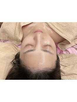 小顔になりたい