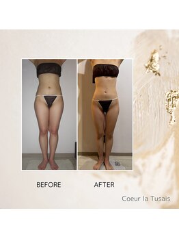 クーラ テュセ(Coeur la Tusais)/全身まるごと痩身