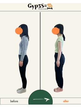 ジップス(Gyp3S=)/猫背も根気強く通うと改善！