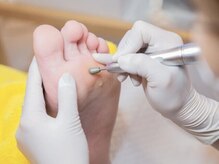 ドクターネイル爪革命 岡山店の雰囲気(繰り返す魚の目・タコも当店にお任せください♪)