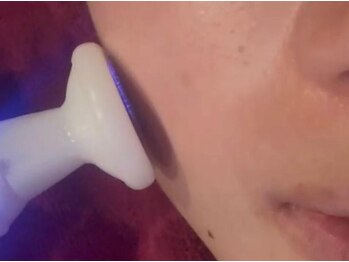 ソルエユニーク(Le seul et unique)の写真/【最新美容機器フェイシャル初回¥15400】毛穴の開きや黒ずみにお悩みの方!キメを整えてツルんとしたお肌へ