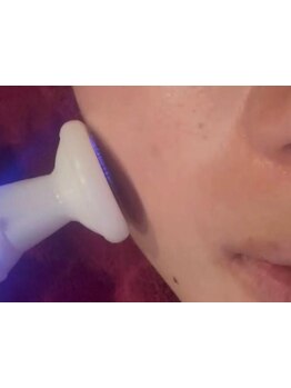 ハリツヤをUPしたい