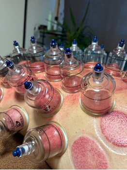 リラクゼーション　hatsuneの写真/かっさ×カッピングで全身の巡りを整える☆老廃物の排出を促進し、冷えやむくみをケアして代謝アップへ♪