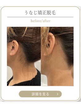 ミース 上野店/プロのうなじ矯正♪