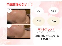 ユピ(Yupi)
