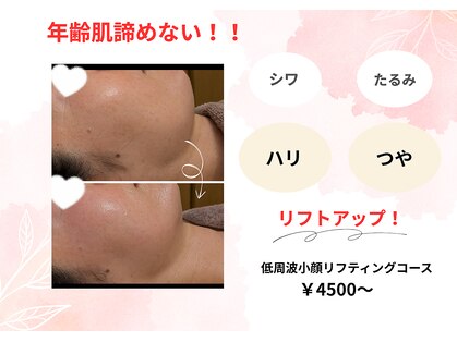 ユピ(Yupi)の写真