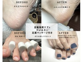 足裏角質・タコのケアで美足に♪