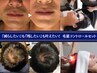 【ヒゲ脱毛+頭皮ケア+α】男の毛量コントロールセット ¥21,800→¥12,000