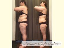 美プレミアム 川越店/施術結果