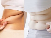 スローティ ラテ 旭川店/自分ではどうにもならない方！