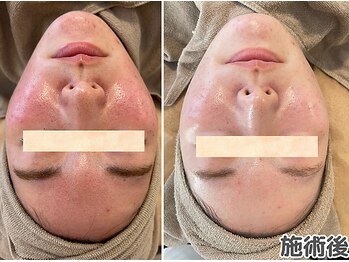 エヴァル 久留米店(ewalu)/バクチオールピール×LDM