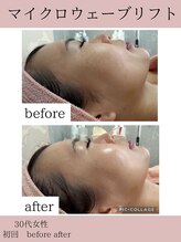 サロンドココ(Salon de COCO)/マイクロウェーブリフト