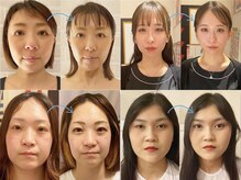 ネルジム 札幌店(NERU GYM)の雰囲気（★当店しかできない手技で顔＆体を激変させます★）