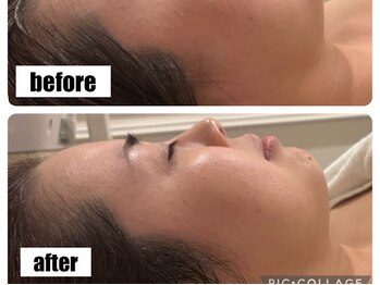 アモ 夢シティ新下関(AMO.)/セラピール