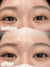 アイモア 吉祥寺店(eye mor.)/まつげパーマ/美眉/アイブロウ