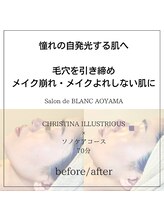 サロン ド ブラン アオヤマ(Salon de BLANC AOYAMA)/クリスティーナ美白ケア