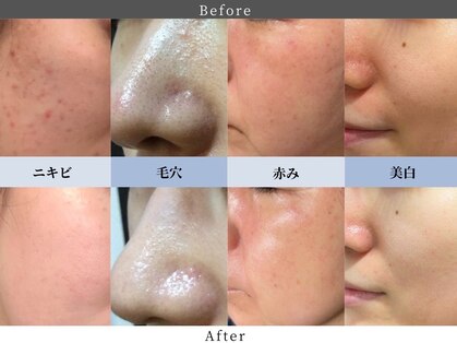 ビボーラ(BEBEAURA)の写真