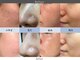 ビボーラ(BEBEAURA)の写真