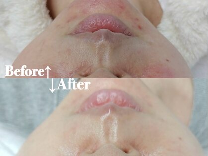 ロゼブランシュ(Rose Blanche)の写真