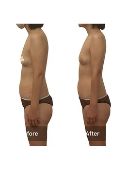 ベンザイ 新潟店(BENZAI)/重心もズレてる事も本人気付かず