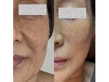 シンプル(Simple)