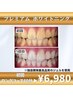 【1番人気☆結果重視の方】歯科提携プレミアムホワイトニング　60分　￥6,980