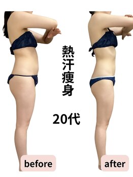 アール シュシュ(R.chouchou)の写真/本気でダイエット◇代謝up!脂肪燃焼!120分じっくりor60分セレクト◇ピッタリのエステで通いやすいサロン◎