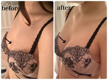 ブレスト 新宿本店(Breast)/《5回目》20代