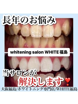 ホワイトニングサロン ホワイト(WHITE)/セルフホワイトニング/大阪/福島