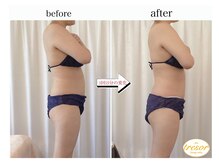 トレゾール(tresor)/★痩身★赤坂痩身エステ